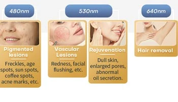 What Are Laser Beauty Treatments?