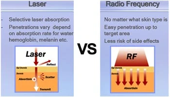 Is CO2 Fractional Laser Better Than Microneedling?