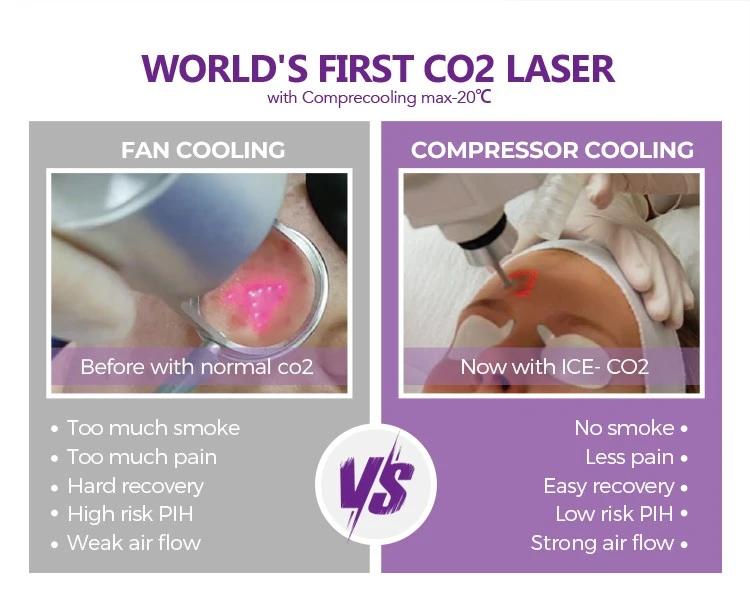 Co2 Laser Resurfacing Machine
