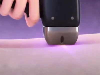 Is Laser Hair Removal Safe?