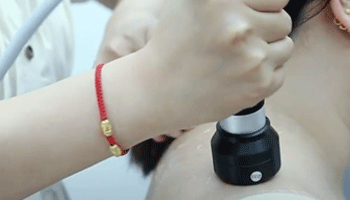 Focused Extracorporeal Shock Wave Therapy