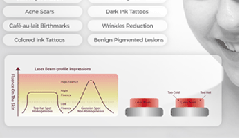 What Is The Newest Tattoo Removal Technology