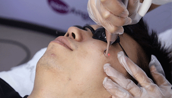 Is Laser Hair Removal Safe For Your Face