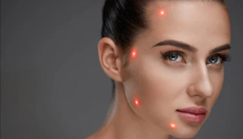 Ablative Vs. Non-Ablative Lasers: Key Differences Explained