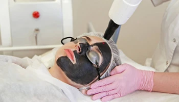 What Is A Carbon Laser Peel?