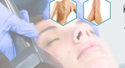 What Is The Aftercare For Fractional RF