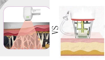 Compare HIFU Vs RF Machines