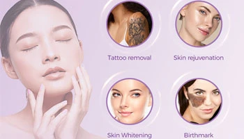 What Is The Best Tattoo Removal Technology in The World