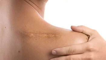 What Is The Best Facial Treatment For Aging Skin
