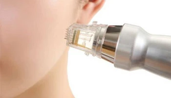 What Is Fractional RF Microneedling?