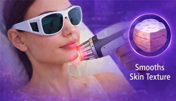 What Is Laser Skin Resurfacing Treatment
